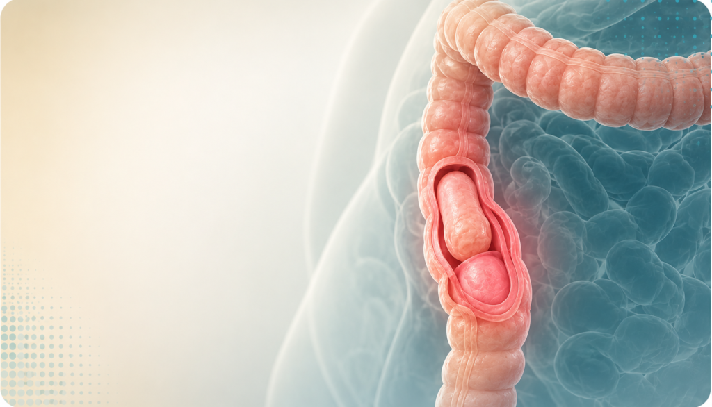 Intussusception